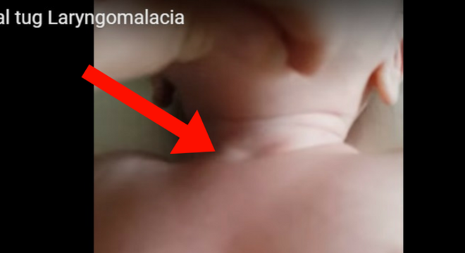 problema-respirar-bebe