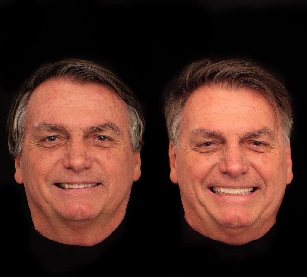 Procedimento odontológico feito por Bolsonaro