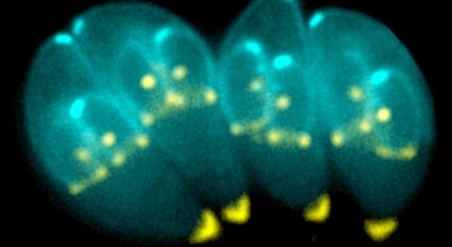 O toxoplasma gondii é o protozoário que causa a toxoplasmose