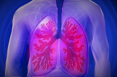 Entenda a infecção pulmonar que ocorre em recuperados da covid-19 