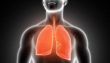 Maioria dos brasileiros desconhece a gravidade do câncer de pulmão, aponta pesquisa