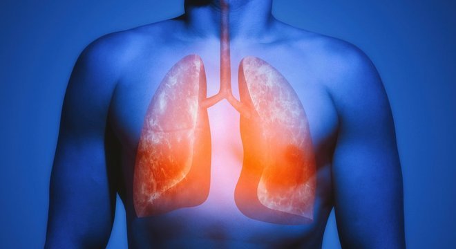 De acordo com os pesquisadores, algumas células pulmonares parecem 'viver em um bunker nuclear'