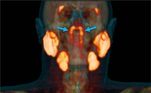 Pesquisadores do Instituto do Câncer da Holanda identificaram umnovo conjunto de órgãos no corpo humano: um quarto par de glândulas salivares,localizadas atrás do nariz, no encontro com a garganta