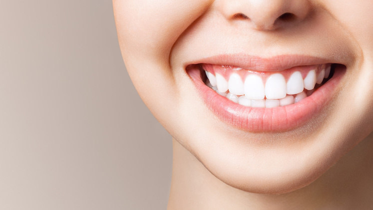 Quem possui dentes amarelados pode optar pelo uso de clareadores dentais.