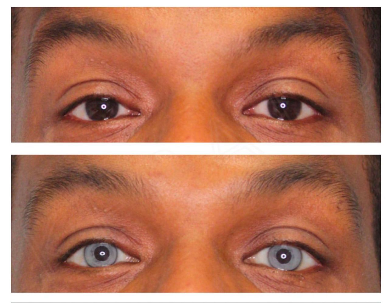 queratopigmentacao-05012024115645910?dimensions=301x301&&amp;&amp;&amp;&amp;&amp;&amp;&amp;&amp;&amp;&amp;&amp;resize=301x301&amp;crop=962x962+167+14&amp;&amp;&amp;&amp;&amp;&amp;&amp;&amp;&amp;&amp;&amp;resize=301x301&amp;crop=962x962+167+14&profile=RESIZE_584x