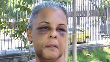 'Tive medo de morrer', diz mulher espancada por lutador no RJ; vítima tinha medida protetiva contra o ex