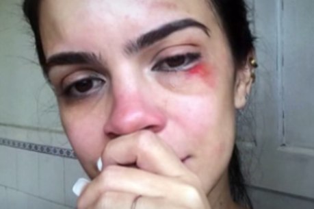 Erika Noronha foi agredida com tapas, chutes, socos e pontapés