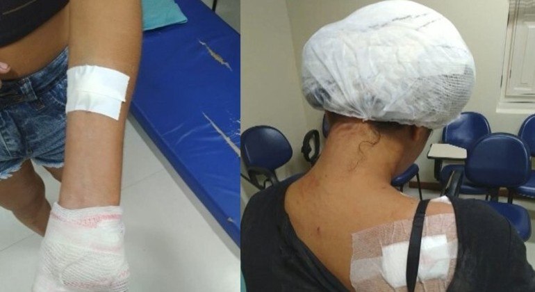 Vítima foi socorrida por vizinhos após ser golpeada durante discussão 
