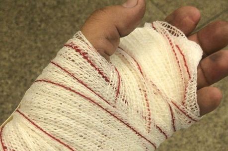 Homem se feriu na mão após pane de armamento