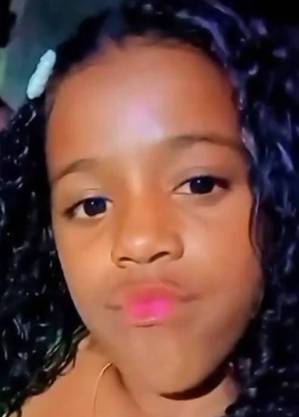 Raquel teve perna amputada 