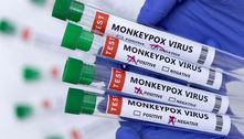 Anvisa recebe novos pedidos de registro de kits para diagnóstico de varíola do macaco