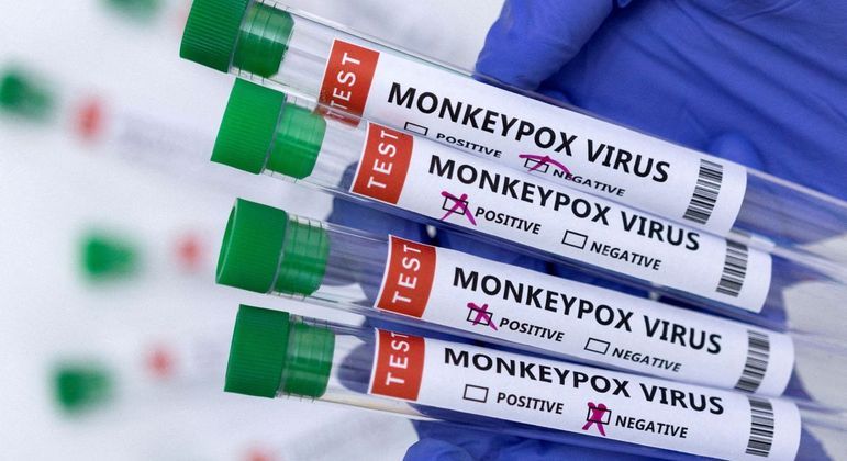 O status atual da varíola do macaco no Brasil é de transmissão comunitária 