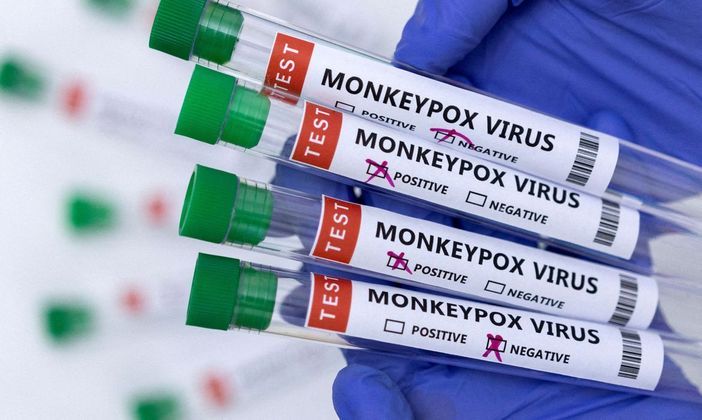 Quando devo fazer o teste? O exame para diagnóstico da varíola do macaco é o PCR — a mesma técnica usada para a Covid — e só pode ser feito após o aparecimento das lesões, segundo o infectologista. Antes disso, o paciente é classificado como um caso suspeito ou provável da doença, segundo as definições do Ministério da Saúde. 