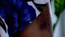 Ex-mulher denuncia ter sido atacada com barra de ferro por policial civil dentro de delegacia