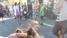 MP denuncia suspeita de atacar adolescente com estilete por ciúmes na zona oeste Rio