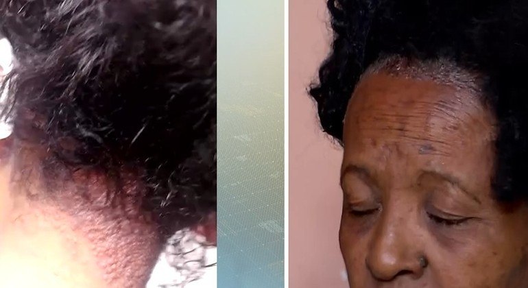 "Estou me sentindo péssima com a autoestima baixa", disse cliente do salão de beleza