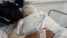 Família diz que motorista ferido em ataques a ônibus, no Rio, teve queimaduras no rosto e no braço
