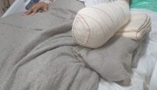 Mulher tem mão amputada após parto normal no Rio; polícia abriu investigação