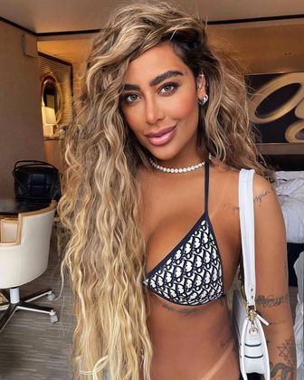 Em 2020, Rafaella encarou uma remodelação orofacial 