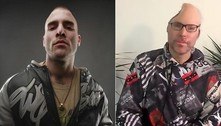 Este rapper perdeu parte do crânio após explodir laboratório de drogas