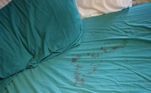 Ela encontrou a cama coberta de sangue e, ao menos, três marcas de mordidas na mão da criançaLEIA MAIS: Cisne invade banheiro e aterroriza aposentada: 'Explosão gigantesca'