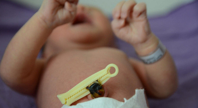 CÃ©lulas do cordÃ£o umbilical nÃ£o podem ser utilizadas pela prÃ³pria pessoa