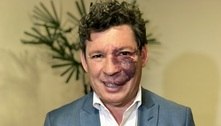 Deputado defende devolução de parte de impostos pagos por pessoas mais pobres