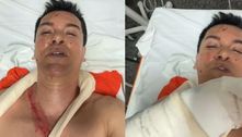 Cantor Regis Danese teve órgão perfurado em acidente e passa por cirurgia de emergência