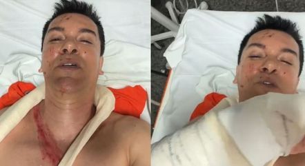 Regis Danese teve órgão perfurado, braço fraturado e costelas quebradas em acidente