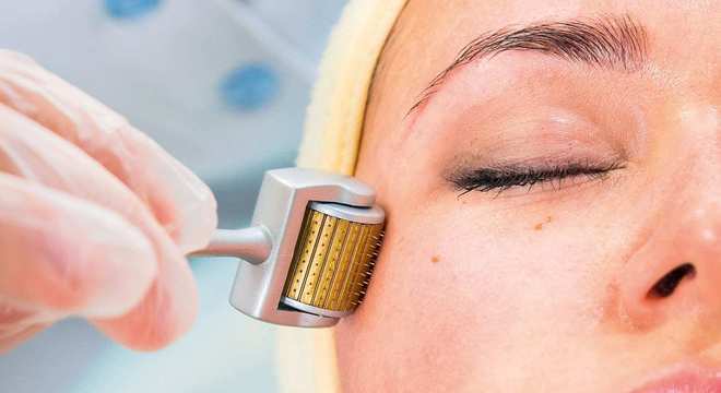 Remédio para melasma - saiba as melhores formas de tratamento