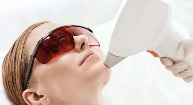 Remédio para melasma - saiba as melhores formas de tratamento