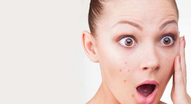 Remédios caseiros para espinha - receitas para acabar com o problema