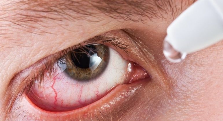 Remela - como são formadas e principais causas de acúmulo nos olhos