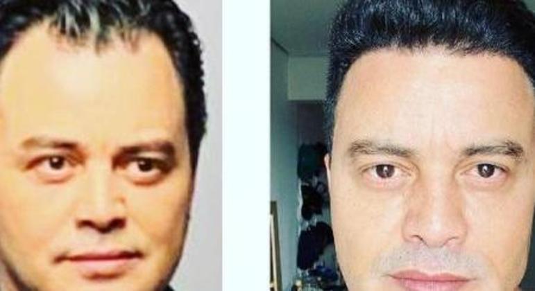 O antes e depois de Renner