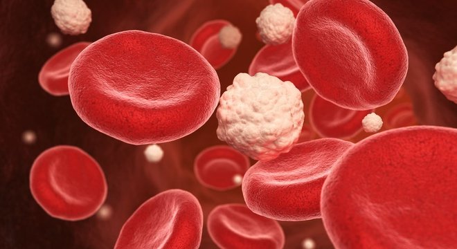 Sintomas da doença só aparecem quando o nível de açúcar no sangue fica muito alto