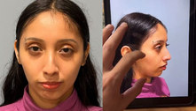 Resultado radical de harmonização facial surpreende web e viraliza: 'Arruma minha cara!'