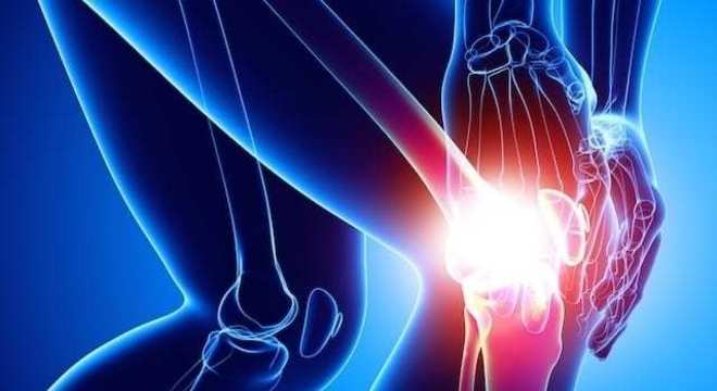 Reumatismo - o que é, principais causas e tratamentos indicados
