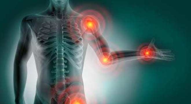 Reumatismo - o que é, principais causas e tratamentos indicados