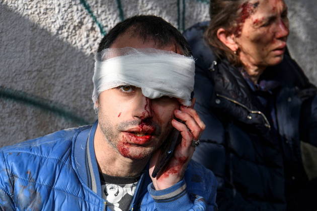 Machucado na cabeça, esse homem tenta falar ao celular logo depois dos ataques russos ao centro da capital Kiev