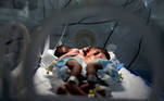 Newly born conjoined twins lie in an incubator at the child intensive care unit of al-Sabeen hospital in Sanaa, Yemen December 18, 2020. REUTERS/Khaled Abdullah TPX IMAGES OF THE DAY