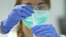 Anvisa pede mudança em teste PCR para diagnóstico de nova cepa