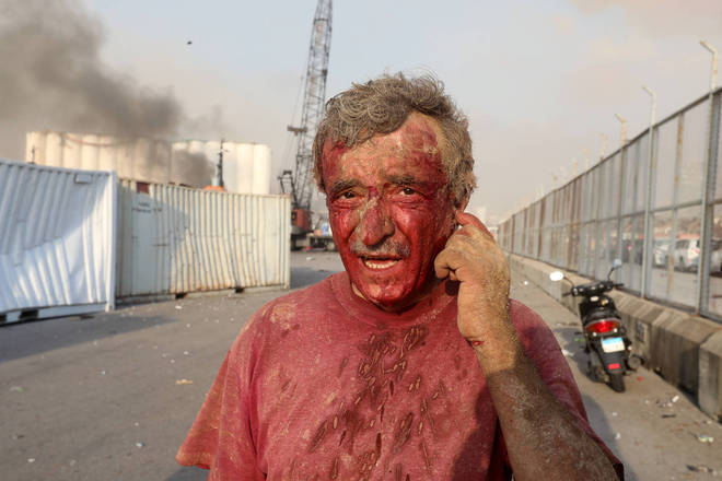 Um ferido, coberto de sangue