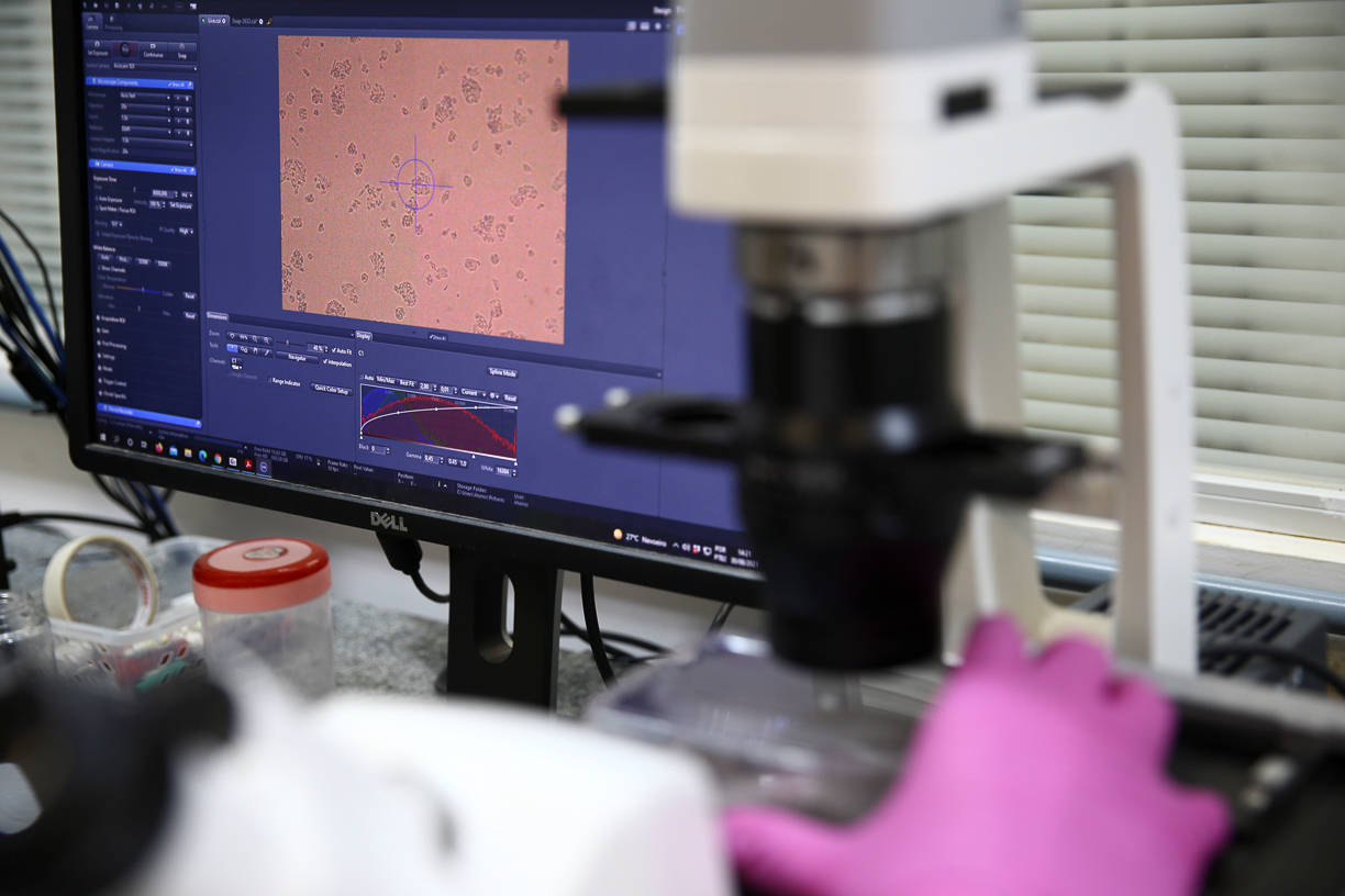 No próximo passo, os pesquisadores vão avaliar a eficiência de diferentes doses da molécula e se ela é capaz de impedir que o vírus entre nas células em primeiro lugar, segundo nota da Universidade Estadual Paulista (Unesp), também envolvida no estudo<br>