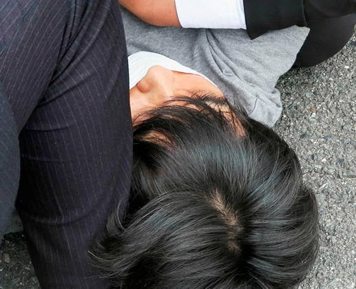 De acordo com o médico responsável pelo caso, Abe foi transportado para o hospital às 12h20. Ele estava em estado de parada cardíaca na chegada ao local, onde realizaram uma reanimação. O óbito do primeiro-ministro foi oficializado às 17h03