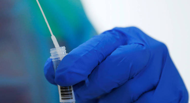 O teste PCR é considerado o mais preciso para confirmar a covid-19