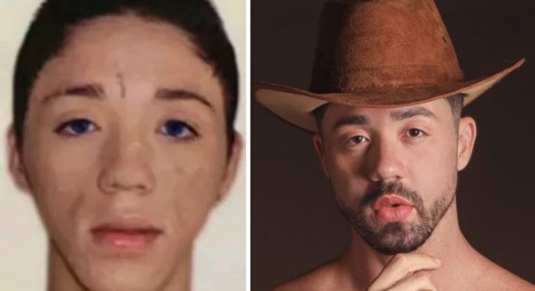 Antes de entrar no reality rural, Rico já tinha gastado R$ 70 mil em uma harmonização facial, que consistiu em mais de dez tipos de procedimento estético, segundo a assessoria de imprensa do humorista. 