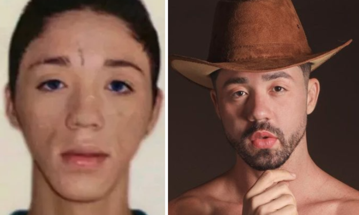 Após uma foto antiga de Rico Melquiades, participante de A Fazenda 13, viralizar na internet, mostrando sua drástica mudança de aparência, a assessoria de imprensa do peão confirmou que ele já se submeteu a uma série de procedimentos para harmonizar o rosto. No total, ele gastou R$ 70 mil com as intervenções estéticas. 'Rico já realizou mais de dez tipos de procedimento, todos nos últimos dez meses. Entre eles, estão sessões de radiofrequência, preenchimento de mandíbulas, lábios e olheiras, além de rinomodelação e outros com o intuito de melhorar manchas e estimular a produção de colágeno', listou a porta-voz do humorista e influenciador digital