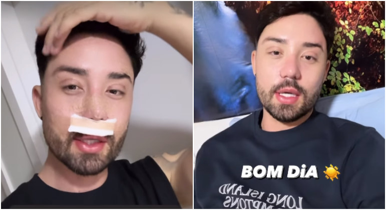 Antes e depois de Rico Melquiades: influenciador revela novo rosto