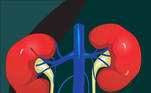 rim-rins-sistema urinário-pedras nos rins