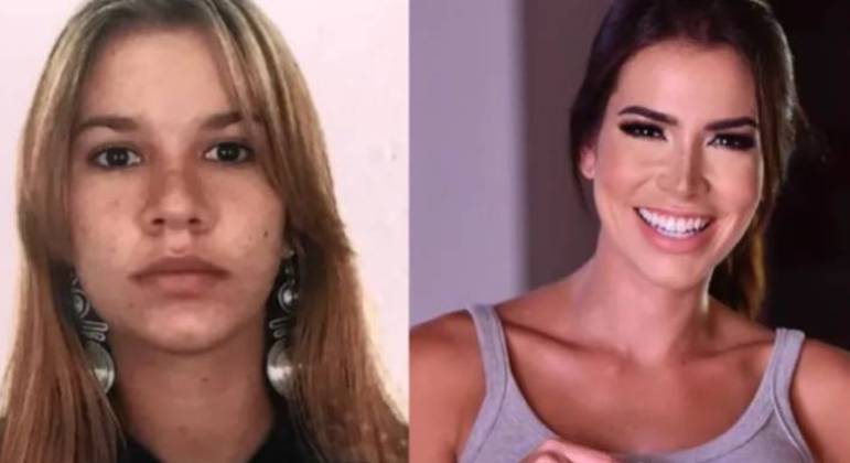 Rodrigão mostra antes e depois de Adriana Sant'anna 
